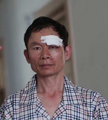 今年40岁的齐全军面部严重受伤,意识尚清晰,但是说不清楚话,尚不能对