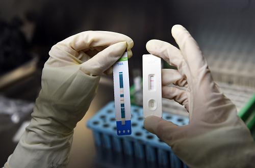 12月1日，第三军医大学新桥医院国家艾滋病确诊实验室内，医生使用HIV抗体的快速试剂进行检测。