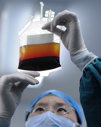3月9日,技术人员在观察脐带血分离后的层面效果。中国唯一的干细胞工程产品产业化基地――天津市脐带血造血干细胞库,目前储存总量已达10万份,成为世界规模最大、储存量最多的干细胞库。天津市脐带血造血干细胞库是首批通过卫生部执业验收的脐带血造血干细胞库之一,也是首批通过亚洲脐带血库组织验收的脐带血造血干细胞库之一,在硬件设备、技术水平、质控标准、数据管理、冷冻储存、医学研发等方面均已达到世界领先水平。运营至今,该库已接受国内外配型查询数千次,为患者查找到HLA(人类白细胞抗原)4个以上位点相合的无关供者脐带血的几率达到97%,提供相合供体的病例150例。