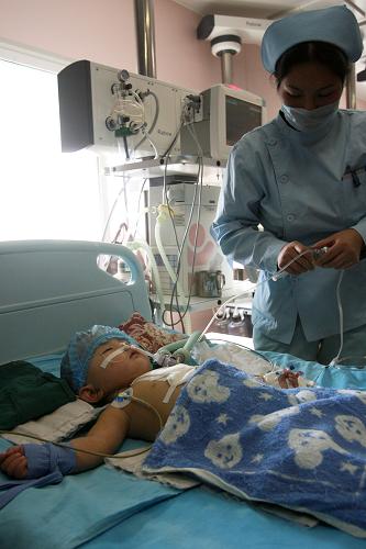 山东为贫困先天性心脏病患儿实施免费手术