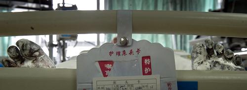 3月21日,正在安徽省合肥市安徽医科大学第一附属医院重症救护室内接受治疗的受害人小黎(化名)双脚被涂抹了大量的药剂药膏,防止病变。新华社记者 郭晨 摄